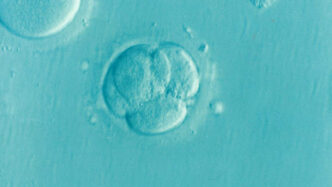 Essentials in Understanding and Embracing the IVF Process