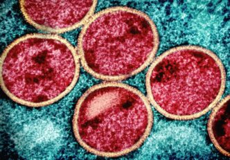 Sierra Leone faces rise in mpox cases